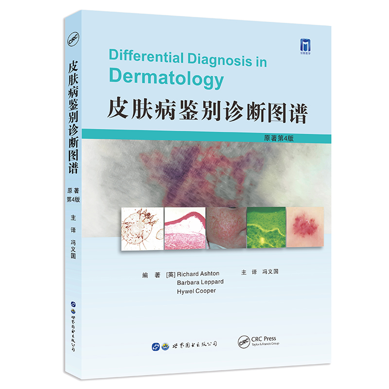 Ƥ�w���b�e�\���D�V��ԭ����4�棩