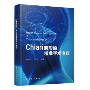 Chiari���εľ���(zh��n)���g(sh��)�ί�