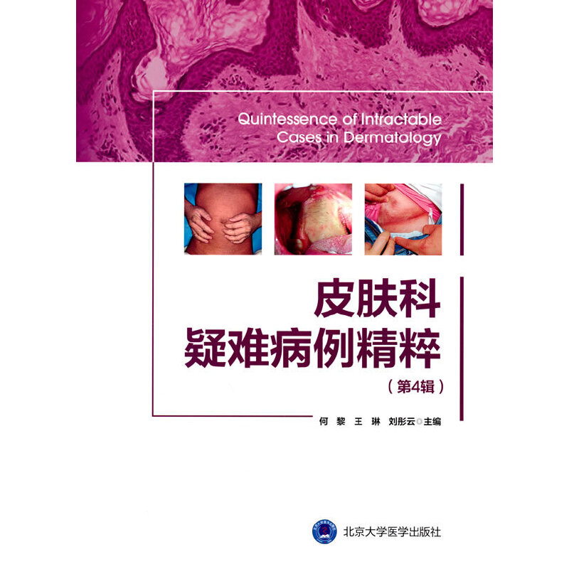 Ƥ�w�����y�������⣨��4݋��