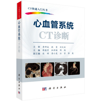 ��Ѫ��ϵ�y(t��ng)CT�\��