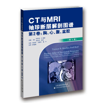 CT�cMRI������ӽ��ʈD�V ��2��-�ء�����������ǻ